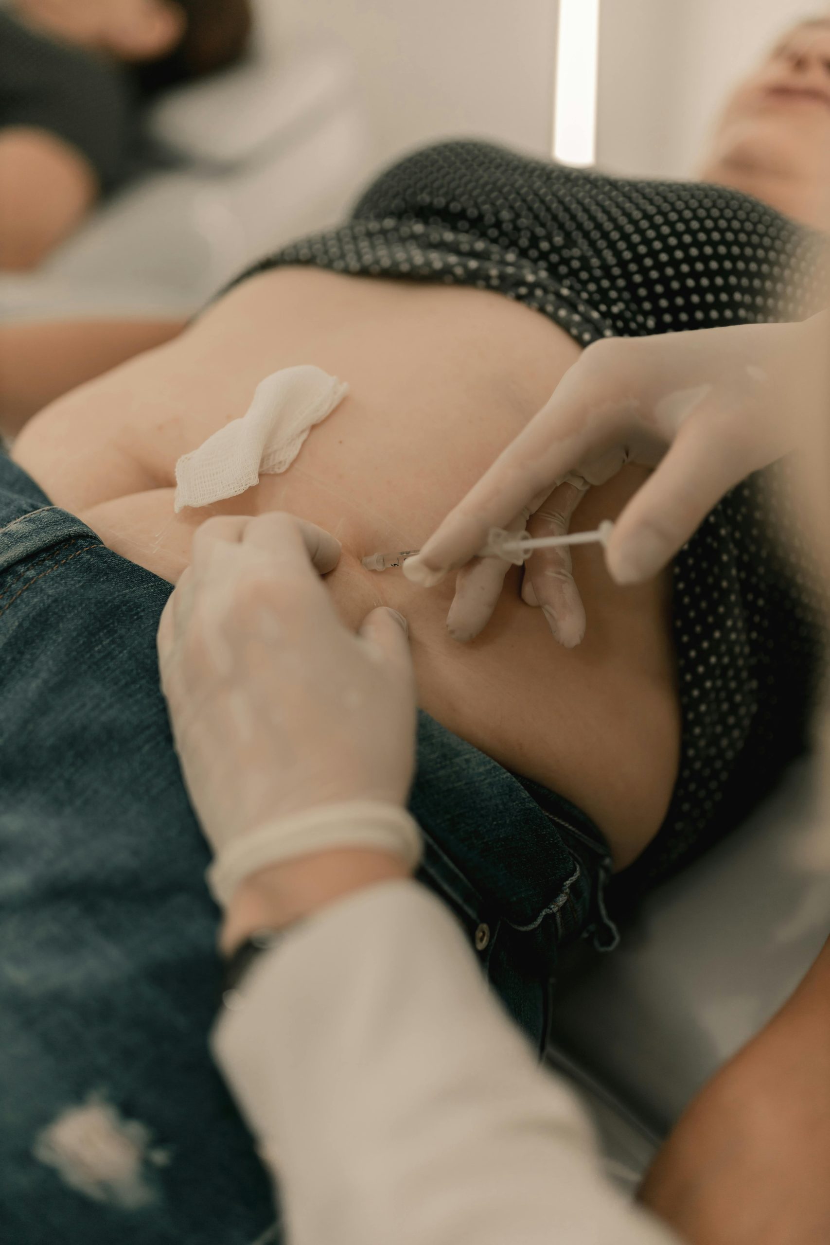 Poids après chirurgie hernie inguinale