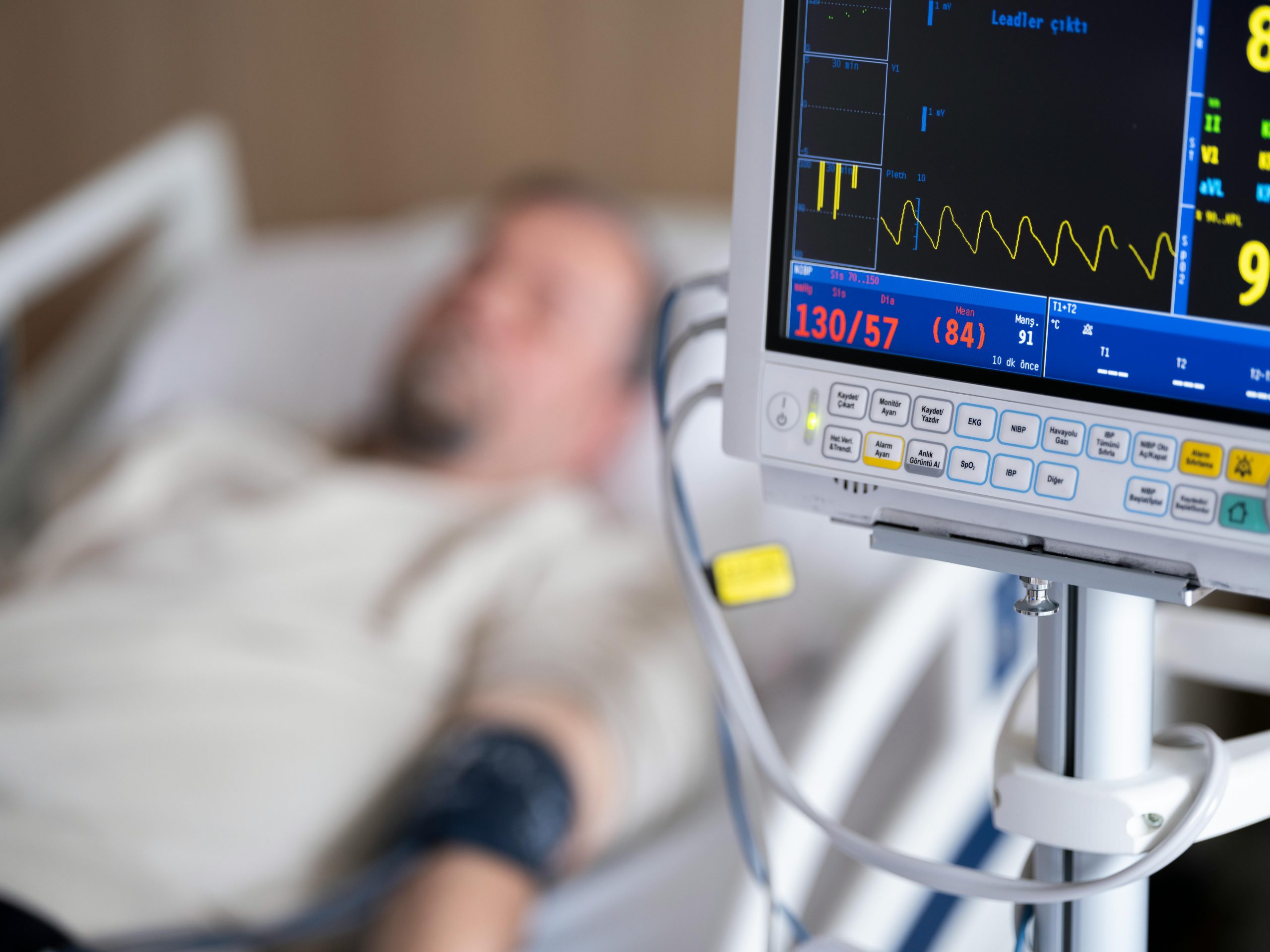Lien entre stress et rêves de crise cardiaque