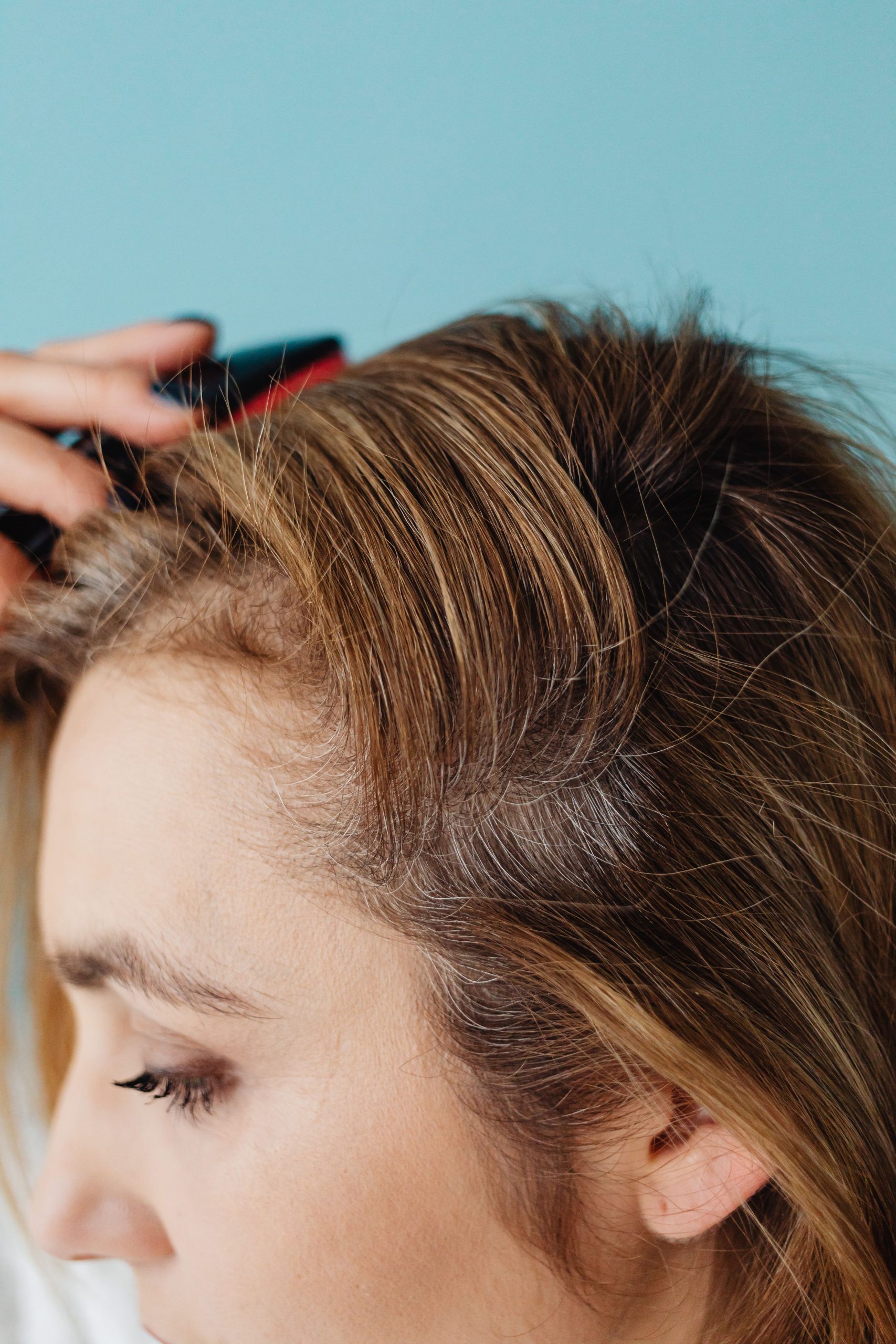 Explications des causes des boutons sur le cuir chevelu