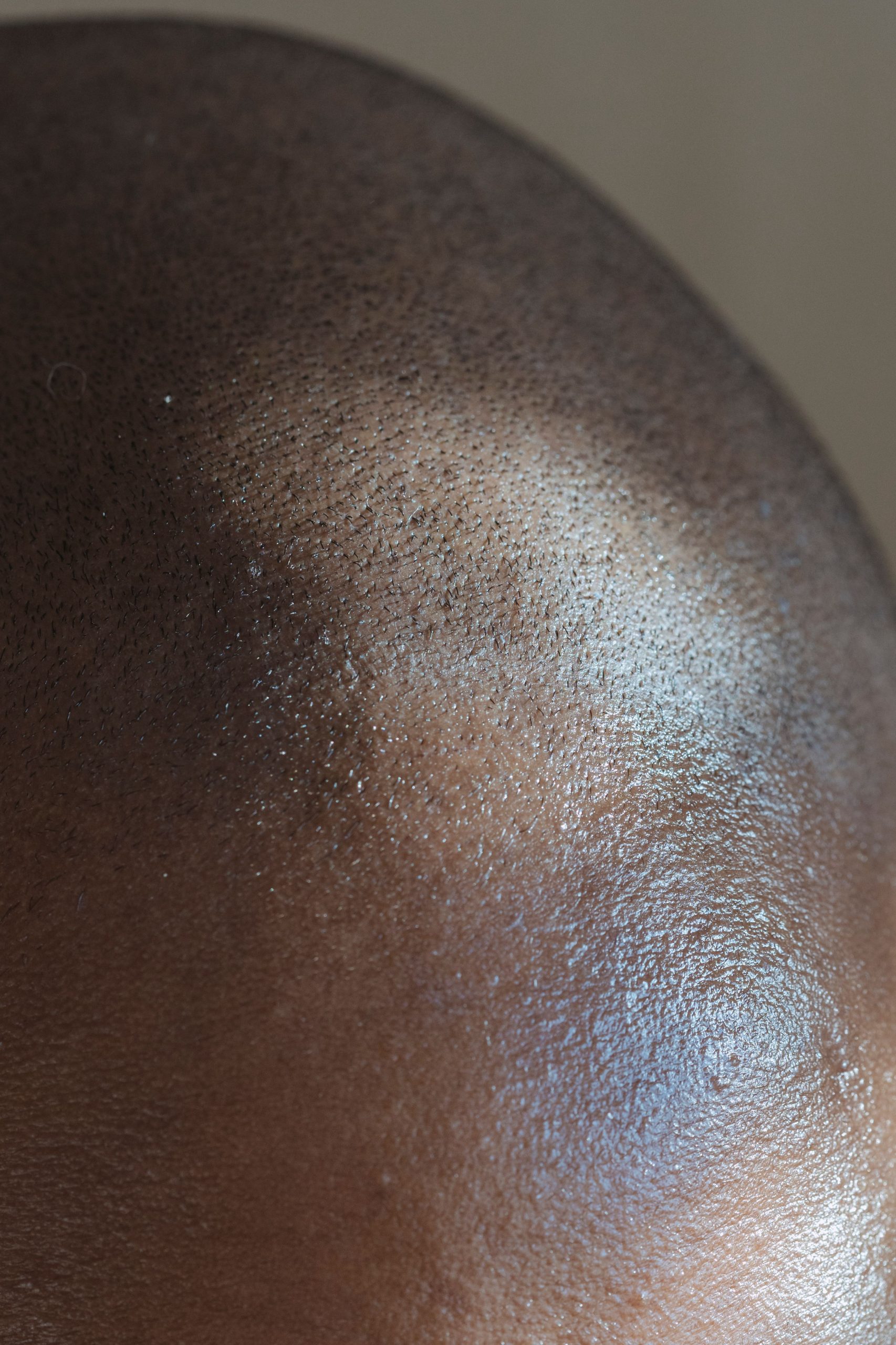 Detailed close-up image showing texture and reflection on a bald head. Image en gros plan détaillée montrant la texture et le reflet sur une tête chauve.