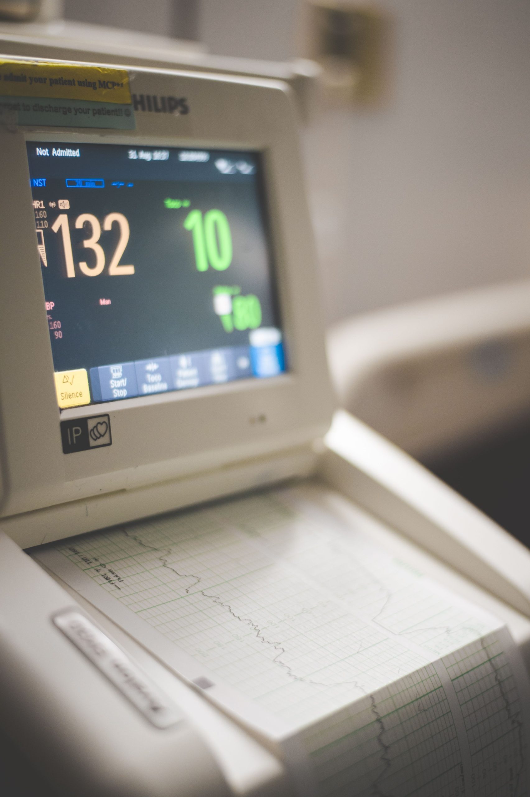 Close-up view of an ECG monitor displaying patient vitals and printed graphs. Vue rapprochée d'un moniteur ECG affichant les signes vitaux du patient et les graphiques imprimés.