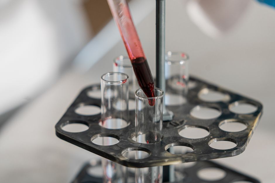 Analyse de sang en laboratoire