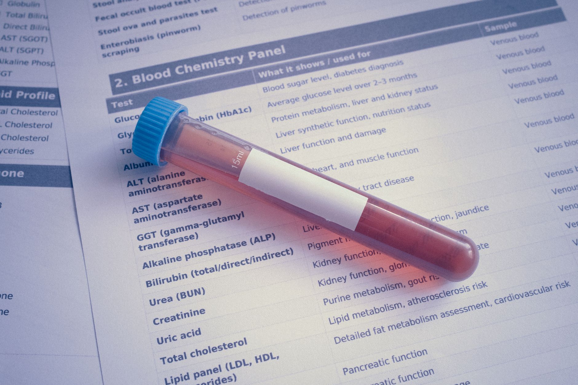 Prélèvement d'échantillon en laboratoire d'analyses